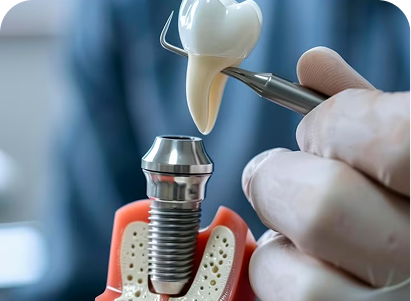 Preventive Dentistry